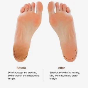 Pretfy Electric Foot Callus Remover Set Rechargeable Foot Grinder Digital ARZV